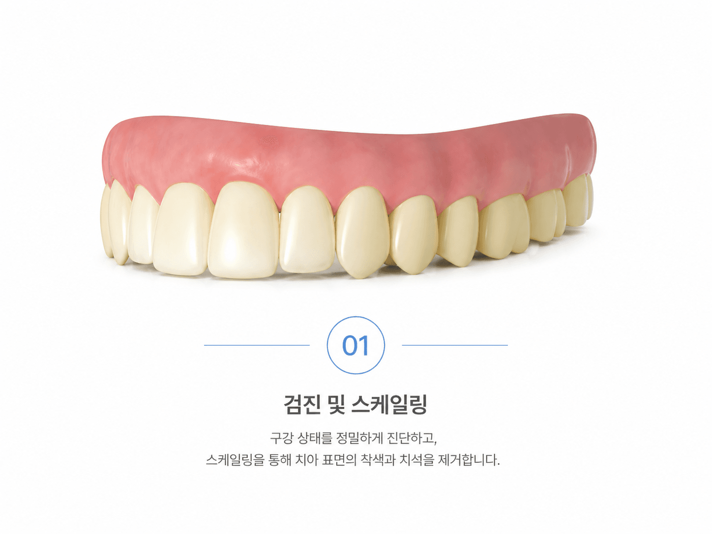 검진 및 스케일링