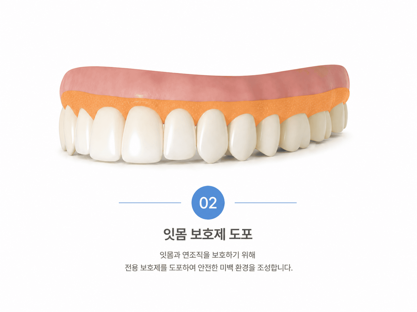 잇몸 보호제 도포