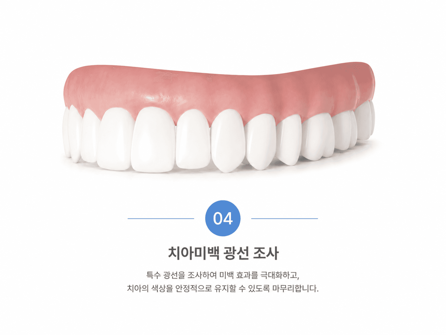 치아미백 광선 조사